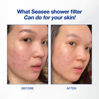SEASEE Rain Shower Filter Kit - Hanya Kit