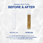 [Refill] SEASEE 12-Month Shower Refill Bundle (More Economic)