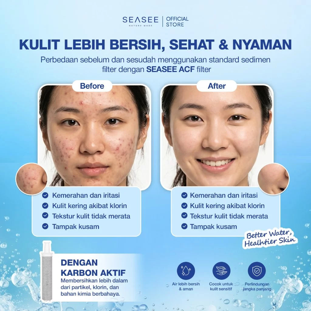 [Isi Ulang] SEASEE Sensitive Skin - Isi Ulang Filter Tubuh Karbon Aktif (1 Pcs)