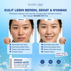 [Isi Ulang] SEASEE Sensitive Skin - Isi Ulang Filter Tubuh Karbon Aktif (1 Pcs)